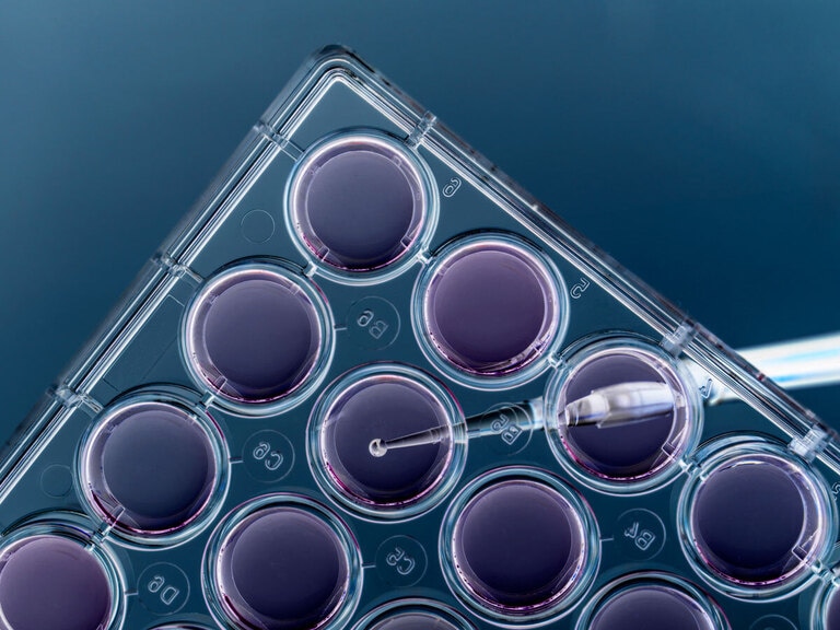 These 3 biotech stocks are highly innovative, but can they turn a profit?